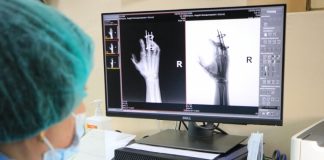 В 16-й больнице Днепра заработал новейший цифровой рентгенаппарат, который делает более 150 снимков в день